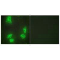 CDK5R1 antibody