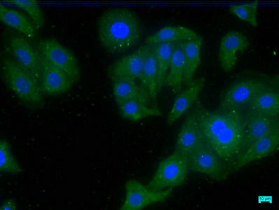 CDK5RAP3 Antibody