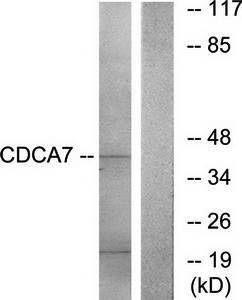 CDCA7 Antibody