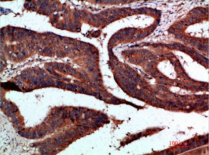 CDK6 Antibody