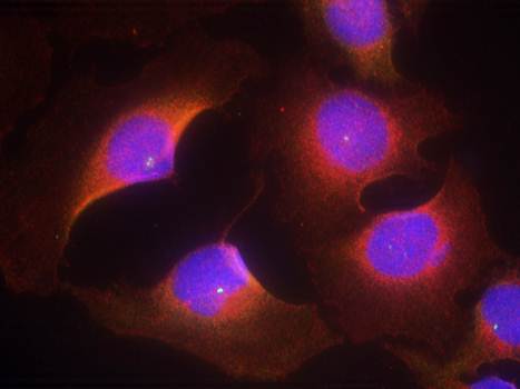 CDK6 (phospho-Tyr13) Antibody