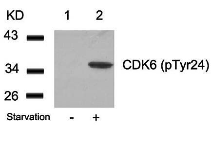 CDK6 (phospho-Tyr24) Antibody
