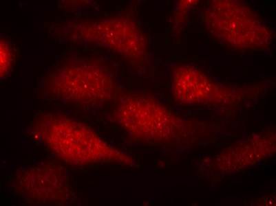 CDK6 (phospho-Tyr24) Antibody