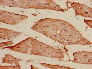 CDKAL1 Antibody