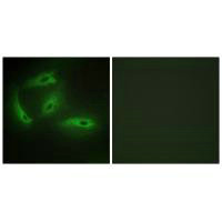 CDKL4 Antibody