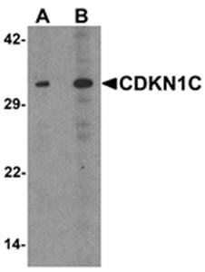CDKN1C Antibody