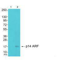 CDKN2A Antibody