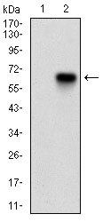 CDKN2A Antibody