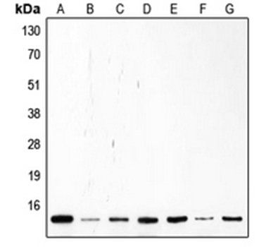 CDKN2A antibody
