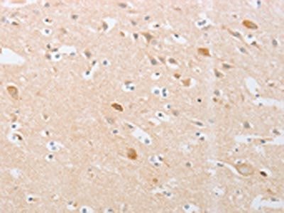 CDKN2AIP Antibody