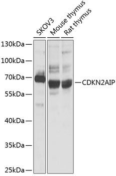 CDKN2AIP antibody