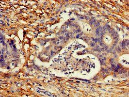 CDKN2C Antibody