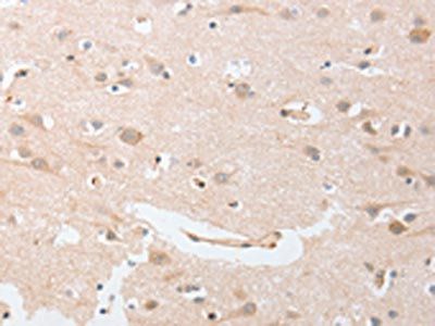CDKN2C Antibody