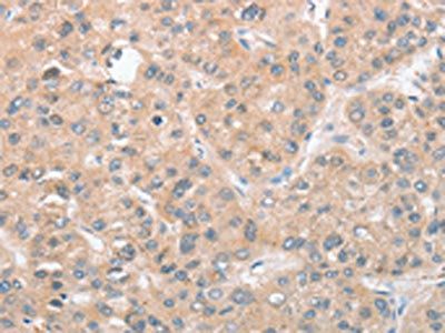 CDKN2C Antibody