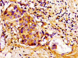 CDKN3 Antibody