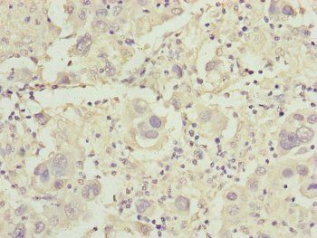 CDO1 Antibody