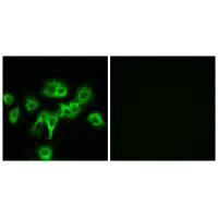 CDON antibody