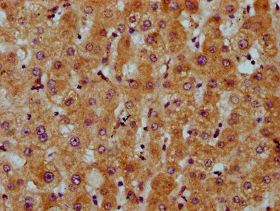 CDS2 Antibody