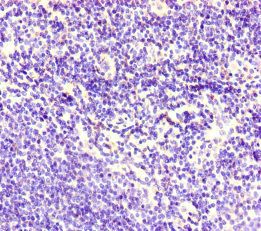 CDSN Antibody
