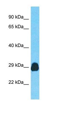 CDV3 antibody