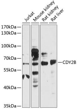 CDY2B antibody