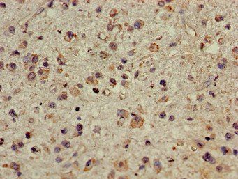 CDYL Antibody