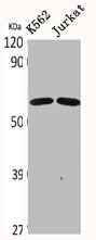 CDYL2 antibody