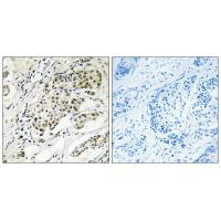 CDYL2 Antibody