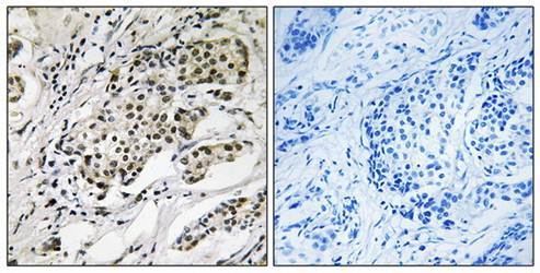 CDYL2 antibody