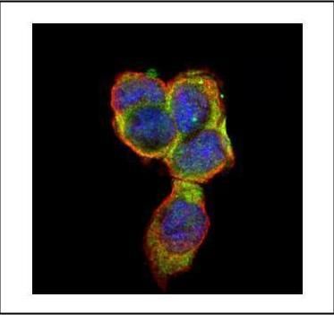 CD66e antibody