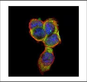 CEA antibody