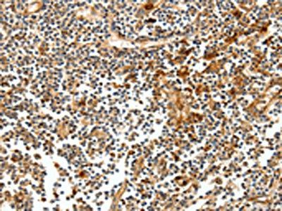 CEACAM21 Antibody