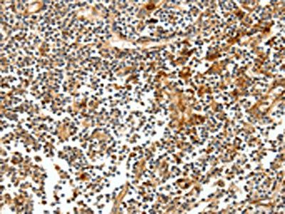 CEACAM21 antibody