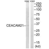 CEACAM21 antibody