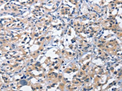 CEACAM3 antibody