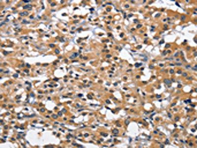 CEACAM3 Antibody