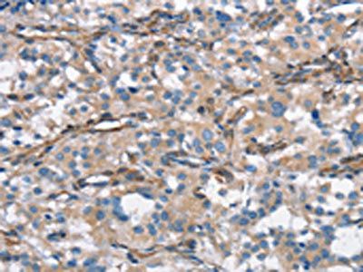 CEACAM3 antibody