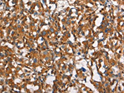 CEACAM3 Antibody