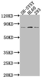 CEACAM5 Antibody