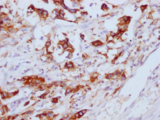 CEACAM5 Monoclonal Antibody
