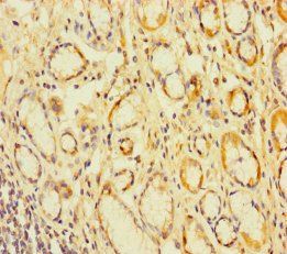 CEACAM7 Antibody