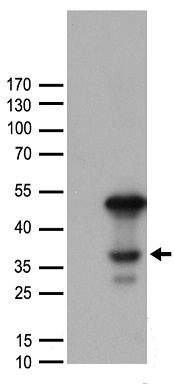 CEBP Alpha (CEBPA) antibody