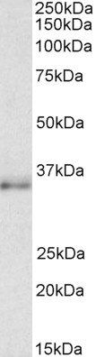 CEBPB antibody