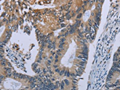 CEBPD Antibody