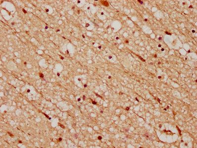 CELF4 Antibody