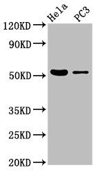 CELF6 antibody