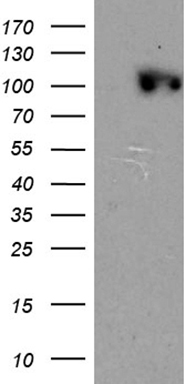 Cellular Apoptosis Susceptibility (CSE1L) antibody