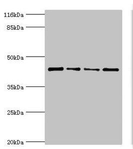 Cellular tumor p53 antibody