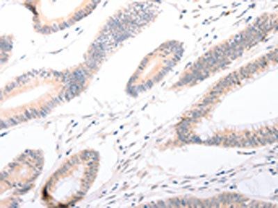 CELSR2 antibody