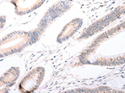CELSR2 Antibody